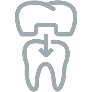 Celokeramika – IPS empress