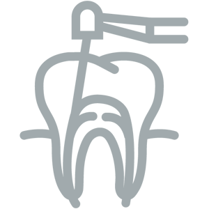 Koreňové kanáliky